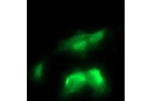 Image no. 5 for anti-V-Ral Simian Leukemia Viral Oncogene Homolog B (Ras Related, GTP Binding Protein) (Ralb) antibody (ABIN1500584)