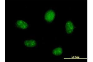 Immunofluorescence of  purified  MaxPab antibody to FTSJ2 on HeLa cell. (FTSJ2 Antikörper  (AA 1-246))