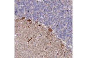 Immunohistochemical staining of human cerebellum with WDR76 polyclonal antibody  shows strong cytoplasmic positivity in purkinje cells at 1:50-1:200 dilution. (WDR76 Antikörper)