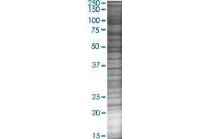 STARD5 transfected lysate. (STARD5 293T Cell Transient Overexpression Lysate(Denatured))