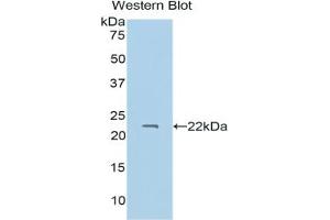 Western blot analysis of the recombinant protein. (PROS1 Antikörper  (AA 301-476))