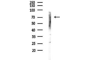 Western blot analysis of lysates from LoVo cells(heat-shock,45 min treatment), using LILR Antibody at 1/1000 dilution.