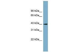 SLC25A22 antibody used at 1 ug/ml to detect target protein. (SLC25A22 Antikörper)