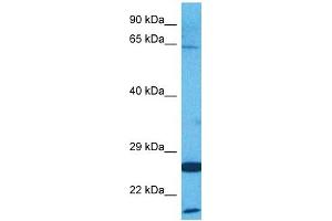 Host:  Rabbit  Target Name:  AMFR  Sample Tissue:  Human HepG2 Whole Cell  Antibody Dilution:  1ug/ml (AMFR Antikörper  (C-Term))