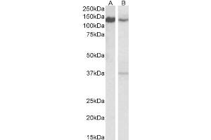 ABIN2613482 (0. (SRRT Antikörper  (C-Term))