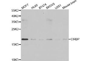 Western blot analysis of extracts of various cell lines, using CIRBP antibody. (CIRBP Antikörper)