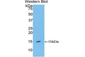 Detection of Recombinant S100A7, Mouse using Polyclonal Antibody to S100 Calcium Binding Protein A7 (S100A7) (S100A7 Antikörper  (AA 1-108))