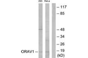Western blot analysis of extracts from 293/HeLa cells, using ORAV1 Antibody. (ORAOV1 Antikörper  (AA 81-130))
