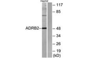 Western blot analysis of extracts from HepG2 cells, using ADRB2 Antibody. (beta 2 Adrenergic Receptor Antikörper  (AA 336-385))