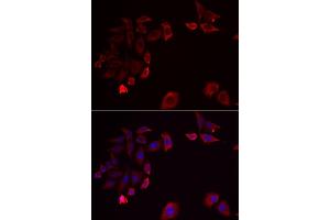 Immunofluorescence analysis of HeLa cells using SK antibody . (SKAP2 Antikörper  (AA 1-120))