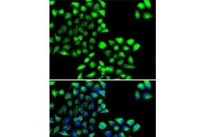 Immunofluorescence analysis of MCF7 cells using COPS6 Polyclonal Antibody (COPS6 Antikörper)