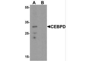 Western blot analysis of CEBPD in rat spleen tissue lysate with CEBPD Antibody  at 0. (CEBPD Antikörper  (C-Term))