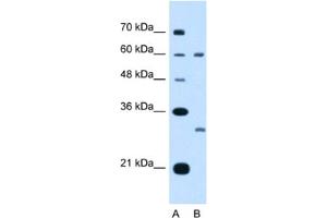 Western Blotting (WB) image for anti-Tetraspanin 32 (TSPAN32) antibody (ABIN2462993) (TSPAN32 Antikörper)