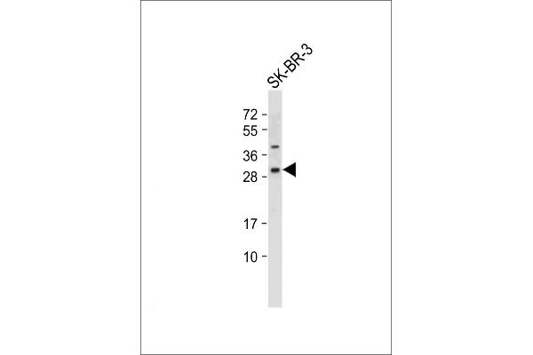 WFDC1 Antikörper  (C-Term)