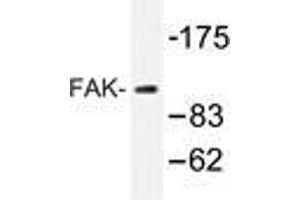 Western blot analysis of FAK antibody in extracts from 293 cells. (FAK Antikörper)