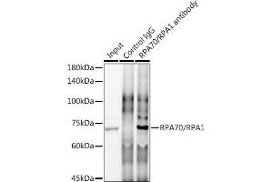 Immunoprecipitation analysis of 300 μg extracts of HeLa cells using 3 μg RP/RP antibody (ABIN7269915). (RPA1 Antikörper)