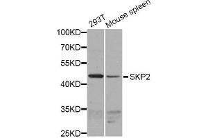 Western blot analysis of extracts of various cell lines, using SKP2 antibody (ABIN1874793) at 1:1000 dilution. (SKP2 Antikörper)
