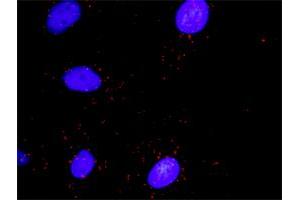 Proximity Ligation Analysis of protein-protein interactions between RHOA and DAAM1. (RHOA Antikörper  (AA 1-193))