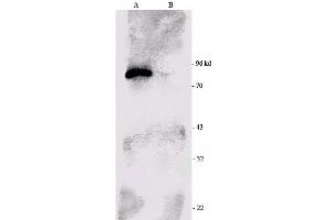 Western blot analysis of Mouse brain cell lysates showing detection of RSK1 protein using Rabbit Anti-RSK1 Polyclonal Antibody .