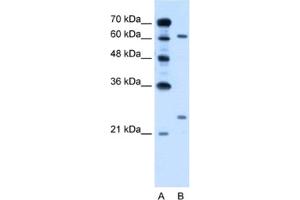 Western Blotting (WB) image for anti-RAR-Related Orphan Receptor A (RORA) antibody (ABIN2462863) (RORA Antikörper)