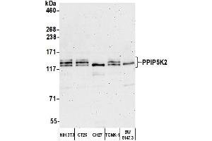 anti-diphosphoinositol Pentakisphosphate Kinase 2 (PPIP5K2) (AA 925-975) antibody