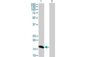 Western Blot analysis of BARX1 expression in transfected 293T cell line by BARX1 monoclonal antibody (M01), clone 1E7.