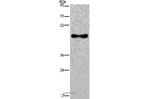 Western blot analysis of Human fetal brain tissue, using FADS1 Polyclonal Antibody at dilution of 1:300 (FADS1 Antikörper)