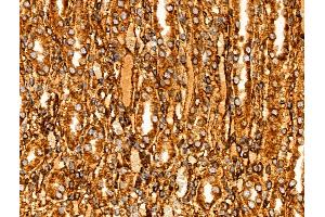 Phospho-PHD2 (Ser125) Antibody at 1/100 staining Rat kidney tissue by IHC-P. (EGLN1 Antikörper  (pSer125))