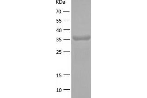 ACAA2 Protein (AA 17-397) (His tag)