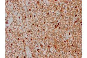 IHC image of ABIN7148527 diluted at 1:300 and staining in paraffin-embedded human brain tissue performed on a Leica BondTM system. (CPNE7 Antikörper  (AA 254-393))