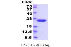 SDS-PAGE (SDS) image for Cyclophilin B (PPIB) (AA 34-216) (Active) protein (His tag) (ABIN6388040) (PPIB Protein (AA 34-216) (His tag))