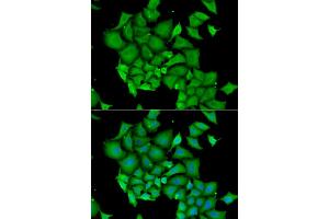 Immunofluorescence analysis of HeLa cells using DFFA antibody. (DFFA Antikörper)