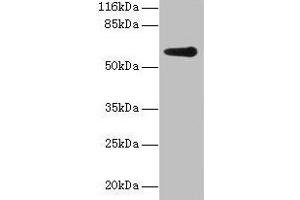 Western blot All lanes: GK2 antibody at 2 μg/mL + Jurkat whole cell lysate Secondary Goat polyclonal to rabbit IgG at 1/10000 dilution Predicted band size: 61 kDa Observed band size: 61 kDa (GK2 Antikörper  (AA 2-553))