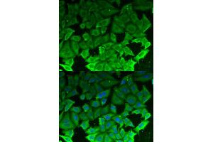 Immunofluorescence analysis of MCF-7 cells using EEF2K antibody. (EEF2K Antikörper)