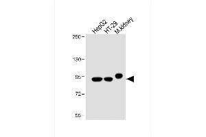 All lanes : Anti-Villin-1 Antibody (N-term) at 1:2000 dilution Lane 1: HepG2 whole cell lysate Lane 2: HT-29 whole cell lysate Lane 3: Mouse kidney lysate Lysates/proteins at 20 μg per lane. (Villin 1 Antikörper  (N-Term))