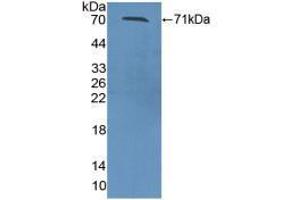 Western blot analysis of recombinant Mouse ZPI. (SERPINA10 Antikörper  (AA 22-448))