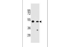 Western blot analysis in CEM,A549 cell line lysates (35ug/lane). (RFWD2 Antikörper  (N-Term))