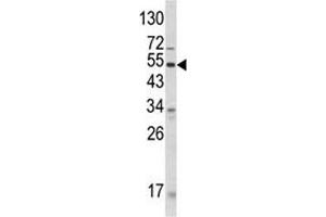 Western blot analysis of ANGPTL3 antibody and human CEM lysate. (ANGPTL3 Antikörper  (AA 82-114))