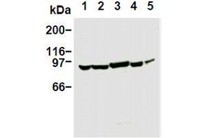 Western Blotting (WB) image for anti-Phosphoinositide 3 Kinase, p85 alpha (PI3K p85a) antibody (ABIN1108652) (PIK3R1 Antikörper)