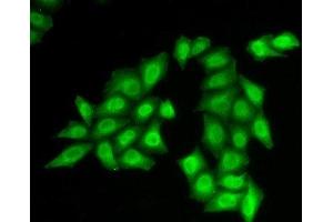 Immunofluorescence analysis of HeLa cells using SSRP1 Polyclonal Antibody (SSRP1 Antikörper)