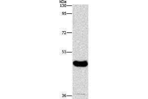 Western blot analysis of Human normal liver tissue, using BAAT Polyclonal Antibody at dilution of 1:600 (BAAT Antikörper)