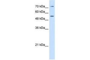 Image no. 1 for anti-Lipopolysaccharide Binding Protein (LBP) (AA 401-450) antibody (ABIN6749720) (LBP Antikörper  (AA 401-450))