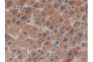 Detection of LCAT in Human Liver Tissue using Polyclonal Antibody to Lecithin Cholesterol Acyltransferase (LCAT) (LCAT Antikörper  (AA 41-210))