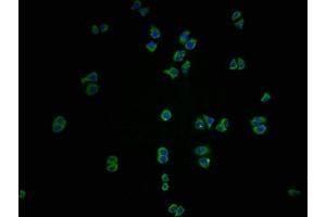 Immunofluorescence staining of PC3 cells with ABIN7156538 at 1:100, counter-stained with DAPI. (ICAM-3/CD50 Antikörper  (AA 200-547))