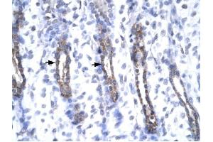 MMP19 antibody was used for immunohistochemistry at a concentration of 4-8 ug/ml to stain Epithelial cells (arrows) in Human Urinary bladder. (MMP19 Antikörper  (N-Term))