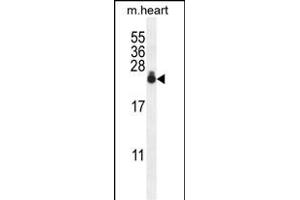 S3 Antibody (N-term) 0390a western blot analysis in mouse heart tissue lysates (35 μg/lane). (AP1S3 Antikörper  (N-Term))