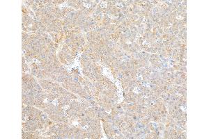 Immunohistochemistry (IHC) image for anti-Coatomer Protein Complex, Subunit beta 2 (COPB2) (AA 856-906) antibody (ABIN7453569) (COPB2 Antikörper  (AA 856-906))