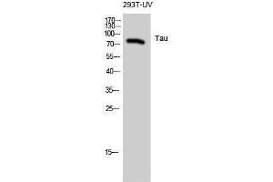 Western Blotting (WB) image for anti-tau Protein (Ser824) antibody (ABIN3187172) (tau Antikörper  (Ser824))