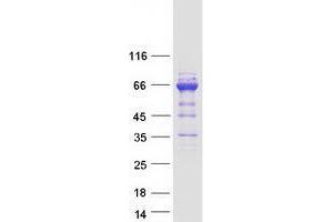 Western Blotting (WB) image for Ubiquitin Associated and SH3 Domain Containing, A (UBASH3A) (Transcript Variant 2) protein (Myc-DYKDDDDK Tag) (ABIN2734772)