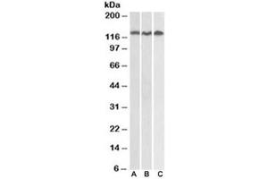 Western blot testing of Daudi (A), Jurkat (B) and HeLa (C) lysates with ADAM17 antibody at 0. (ADAM17 Antikörper)